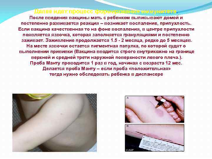 Далее идет процесс формирования иммунитета. После введения вакцины мать с ребенком выписывают домой и