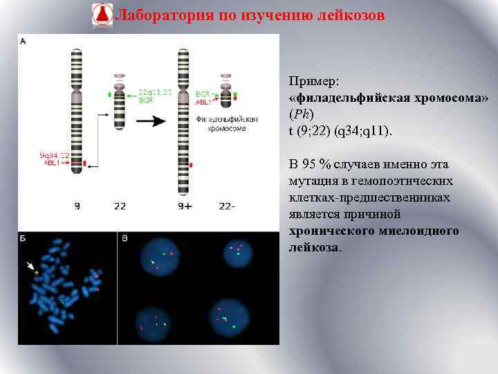 Лаборатория по изучению лейкозов Пример: «филадельфийская хромосома» (Ph) t (9; 22) (q 34; q
