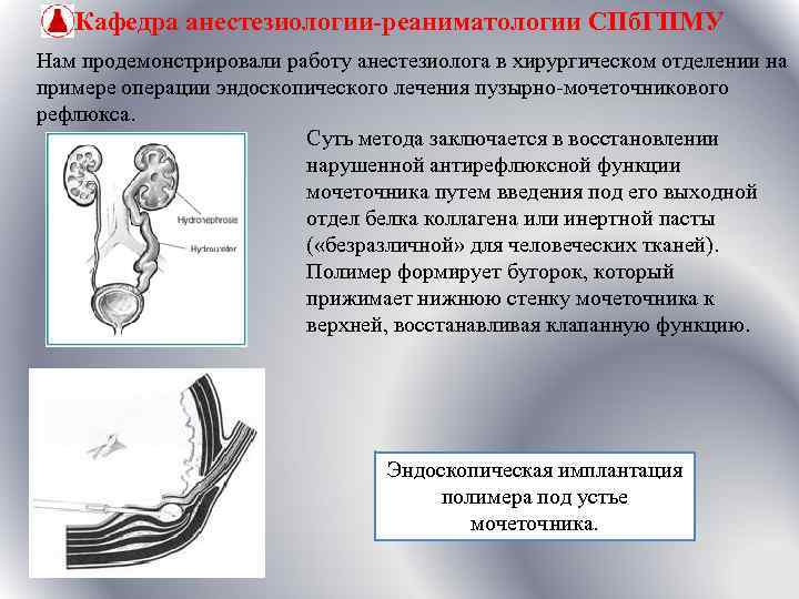 Кафедра анестезиологии-реаниматологии СПб. ГПМУ Нам продемонстрировали работу анестезиолога в хирургическом отделении на примере операции