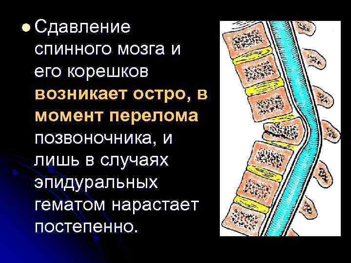 l Сдавление спинного мозга и его корешков возникает остро, в момент перелома позвоночника, и