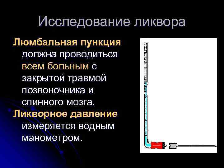 Исследование ликвора Люмбальная пункция должна проводиться всем больным с закрытой травмой позвоночника и спинного