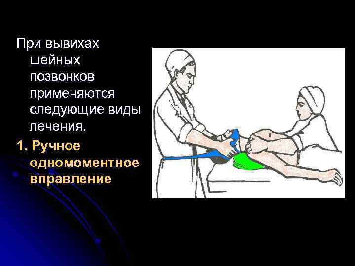 При вывихах шейных позвонков применяются следующие виды лечения. 1. Ручное одномоментное вправление 