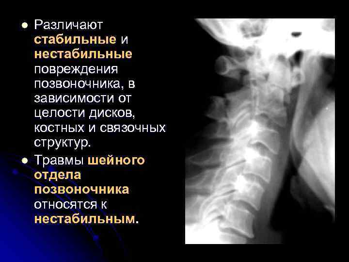 l l Различают стабильные и нестабильные повреждения позвоночника, в зависимости от целости дисков, костных