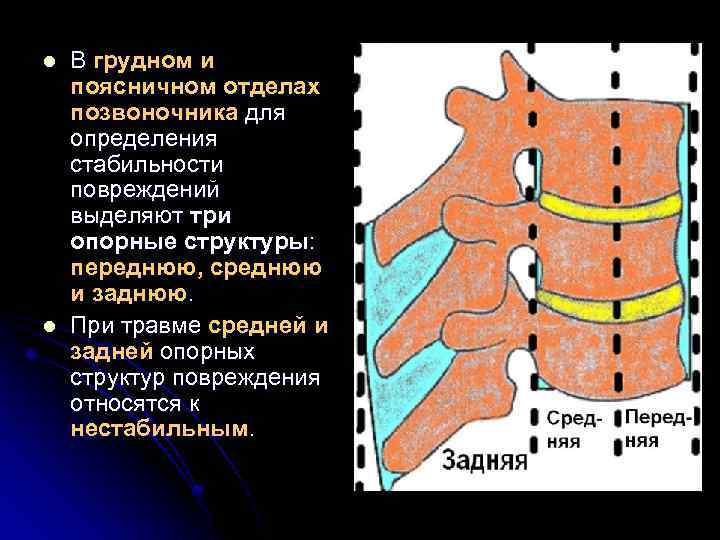 l l В грудном и поясничном отделах позвоночника для определения стабильности повреждений выделяют три