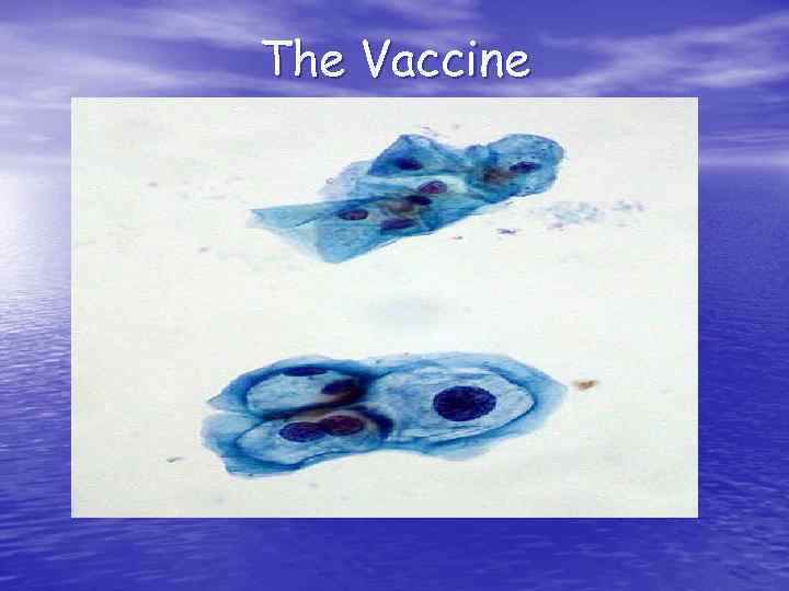 The Vaccine 