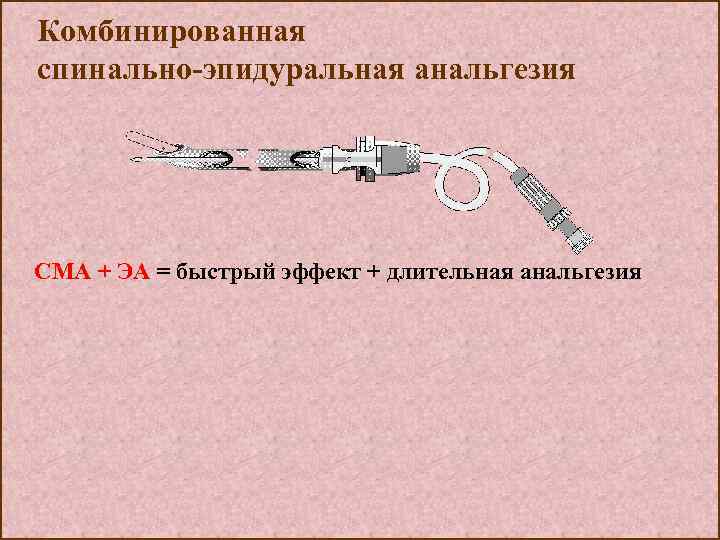 Комбинированная спинально-эпидуральная анальгезия СМА + ЭА = быстрый эффект + длительная анальгезия 