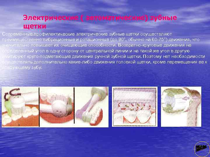 Электрические ( автоматические) зубные щетки Современные профилактические электрические зубные щетки осуществляют преимущественно вибрационные и