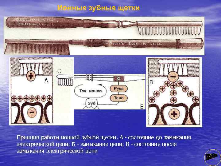 Ионные зубные щетки А В Б Принцип работы ионной зубной щетки. А состояние до