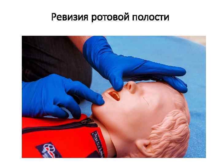 Ревизия ротовой полости 