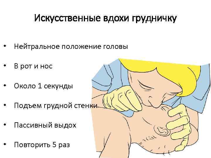 Искусственные вдохи грудничку • Нейтральное положение головы • В рот и нос • Около