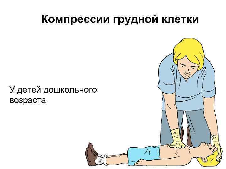 Компрессии грудной клетки У детей дошкольного возраста 
