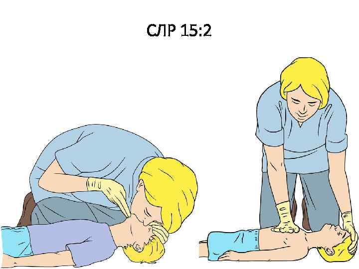 СЛР 15: 2 