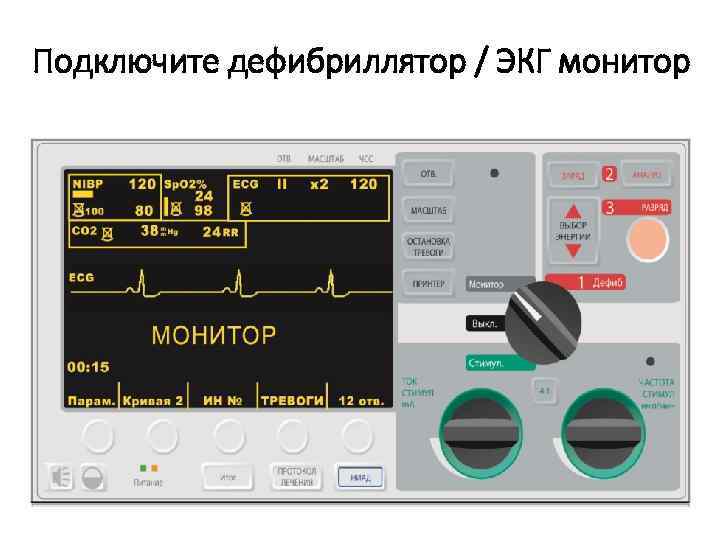 Подключите дефибриллятор / ЭКГ монитор 