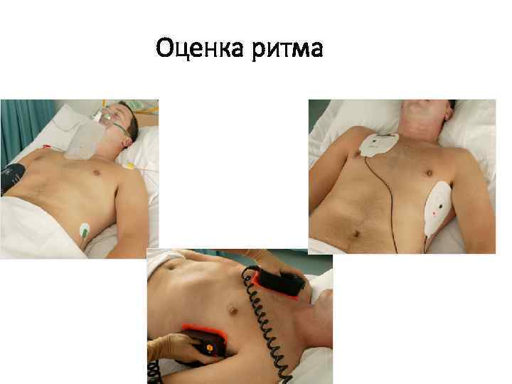 Оценка ритма 