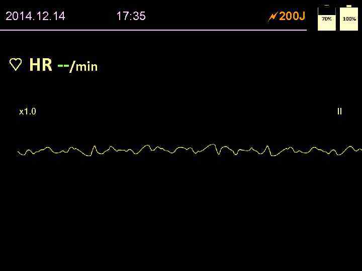 2014. 12. 14 17: 35 200 J HR --/min x 1. 0 II 