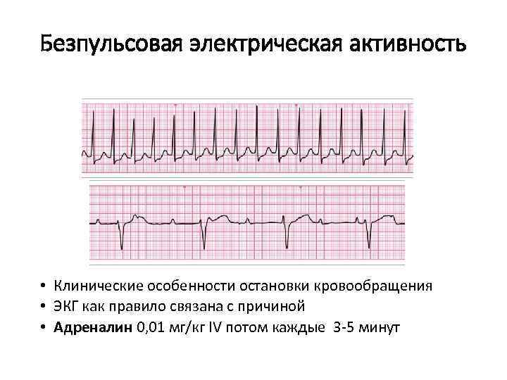 Увеличение электрической активности