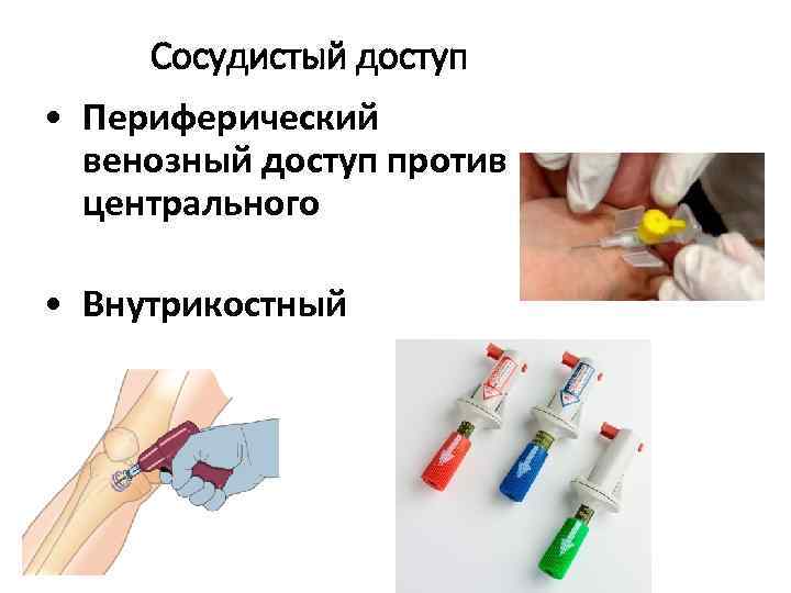 Сосудистый доступ • Периферический венозный доступ против центрального • Внутрикостный 