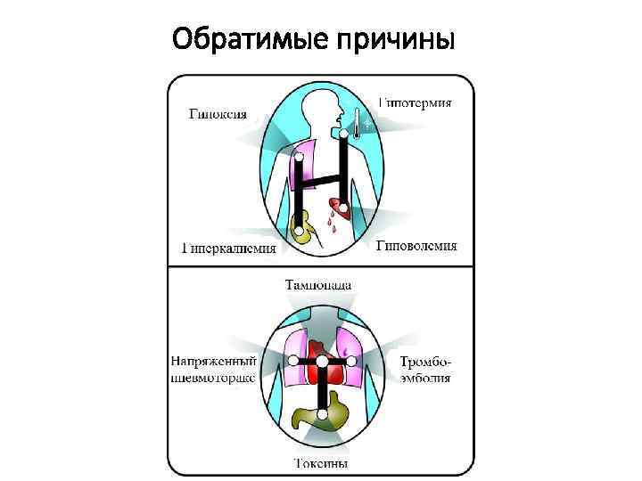 Обратимые причины 