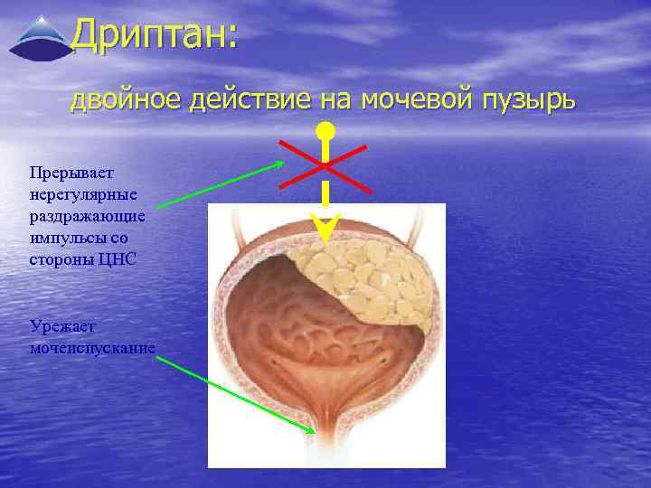 Пролапс тазовых органов презентация