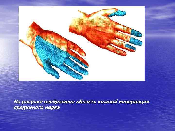 На рисунке изображена область кожной иннервации срединного нерва 