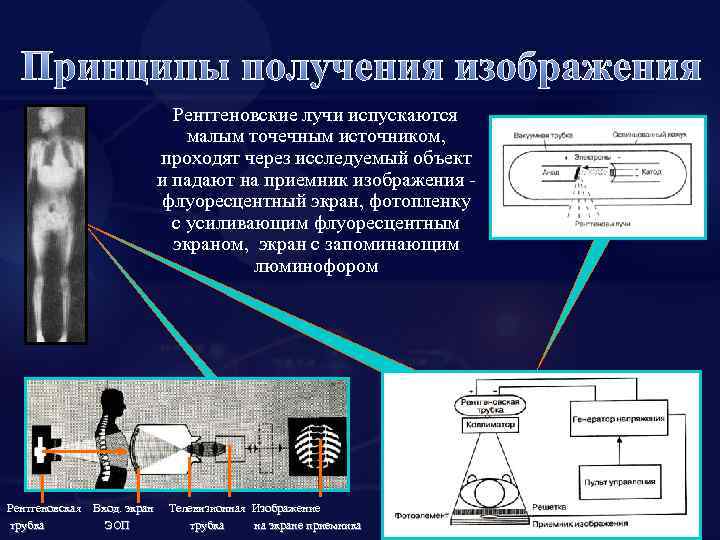 Для образования рентгеновского изображения необходимо