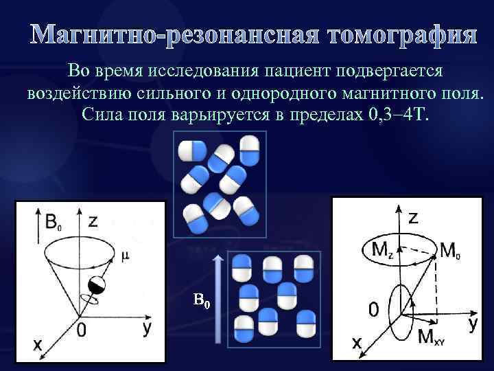 Магнитно-резонансная томография Во время исследования пациент подвергается воздействию сильного и однородного магнитного поля. Сила