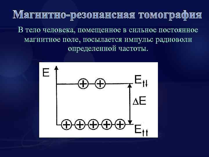 Магнитно-резонансная томография В тело человека, помещенное в сильное постоянное магнитное поле, посылается импульс радиоволн