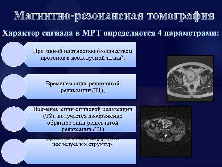 На т2 взвешенных изображениях при нативной магнитно резонансной томографии хорошо визуализируются