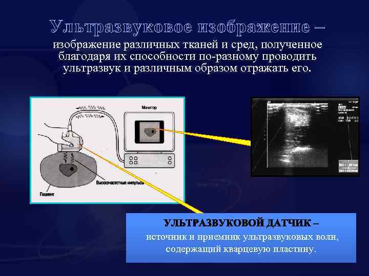 Принципы получения ультразвукового изображения сердца в трех режимах сканирования