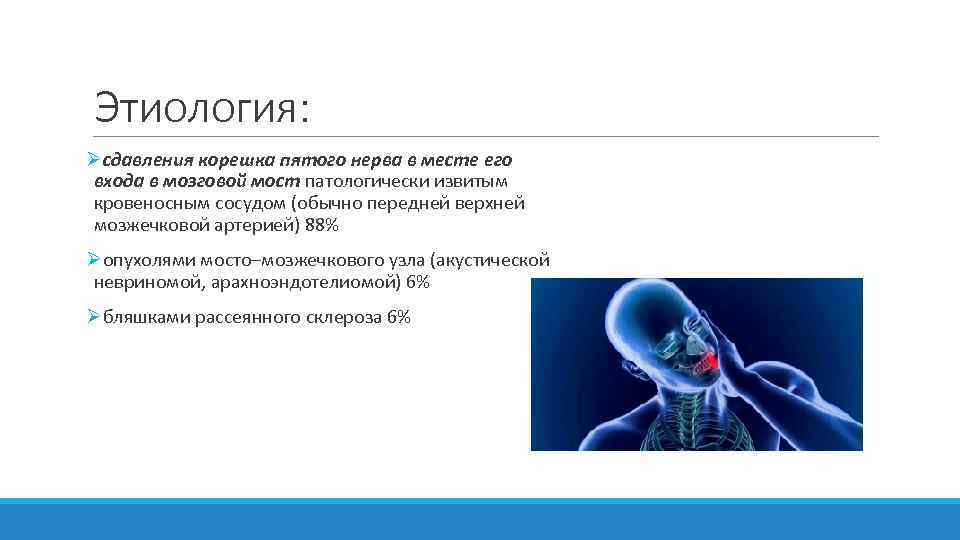 Этиология: Øсдавления корешка пятого нерва в месте его входа в мозговой мост патологически извитым