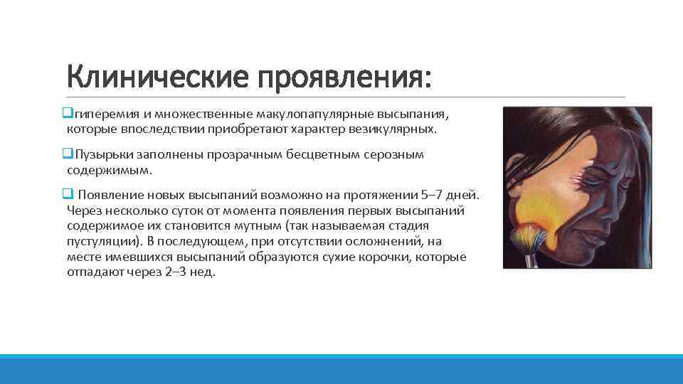 Клинические проявления: qгиперемия и множественные макулопапулярные высыпания, которые впоследствии приобретают характер везикулярных. q. Пузырьки