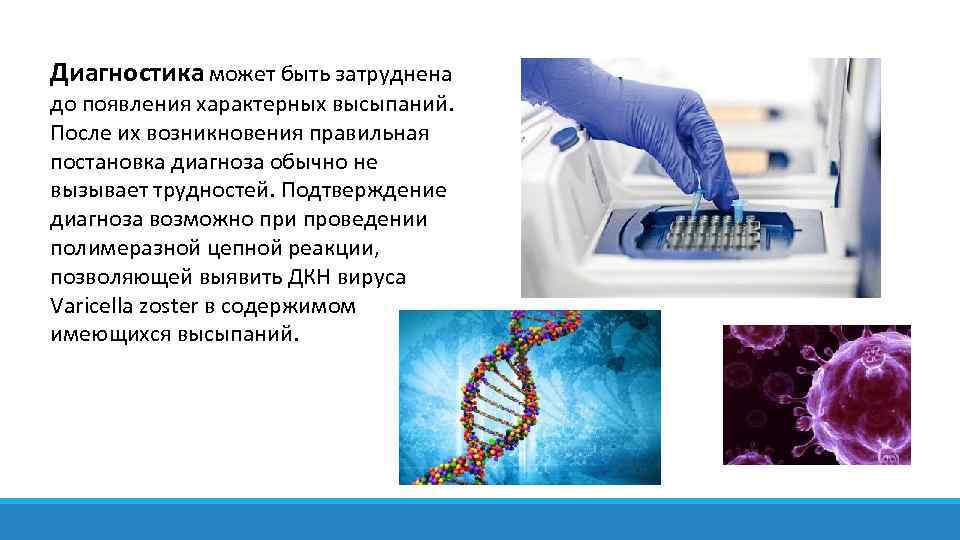 Диагностика может быть затруднена до появления характерных высыпаний. После их возникновения правильная постановка диагноза