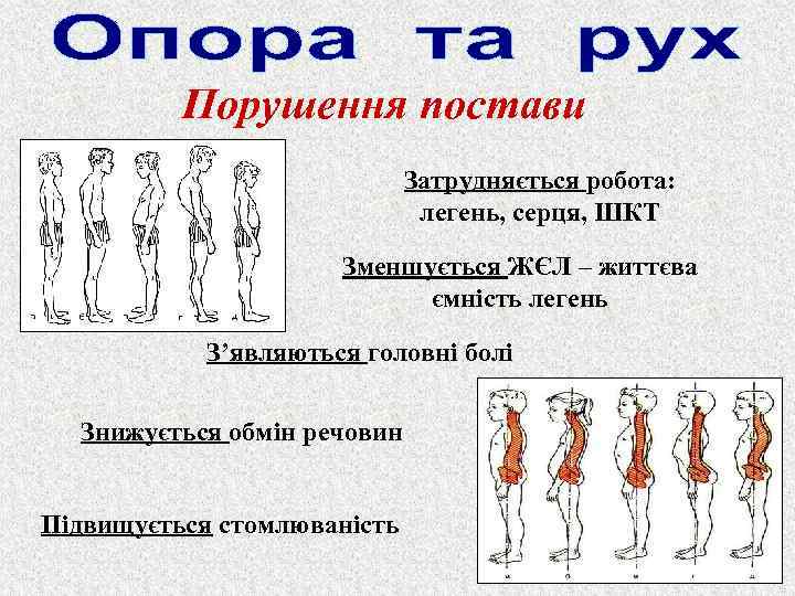 Порушення постави Затрудняється робота: легень, серця, ШКТ Зменшується ЖЄЛ – життєва ємність легень З’являються