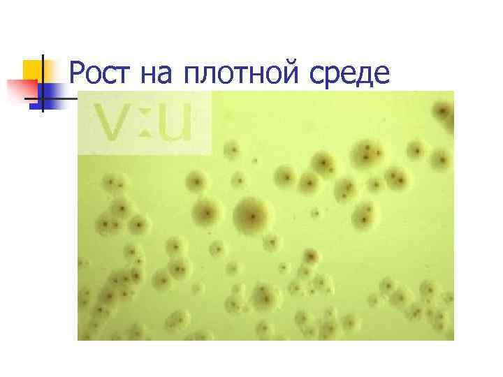 Рост на плотной среде 