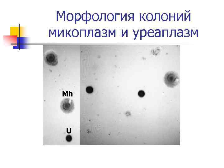 Морфология колоний микоплазм и уреаплазм 