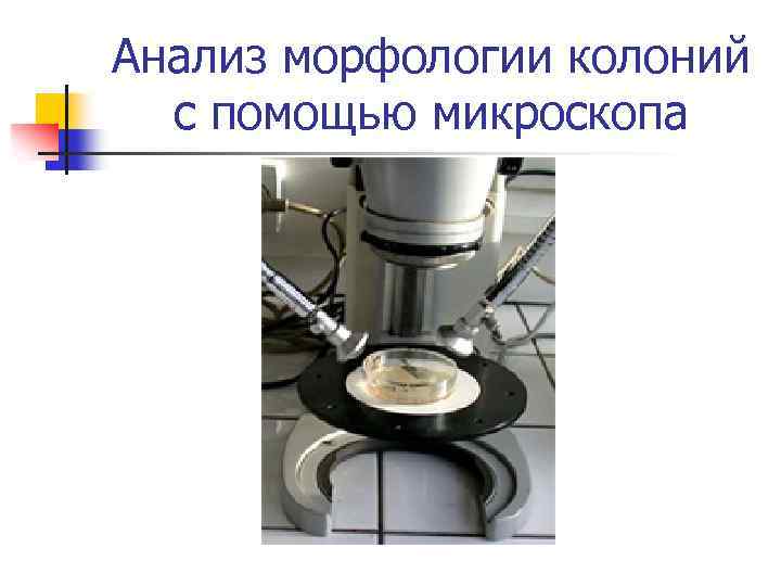 Анализ морфологии колоний с помощью микроскопа 