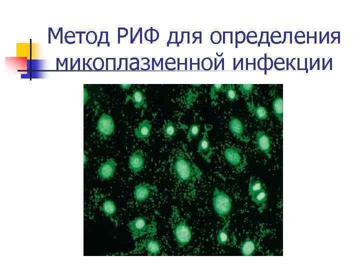Метод РИФ для определения микоплазменной инфекции 