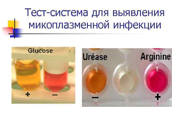 Тест-система для выявления микоплазменной инфекции 