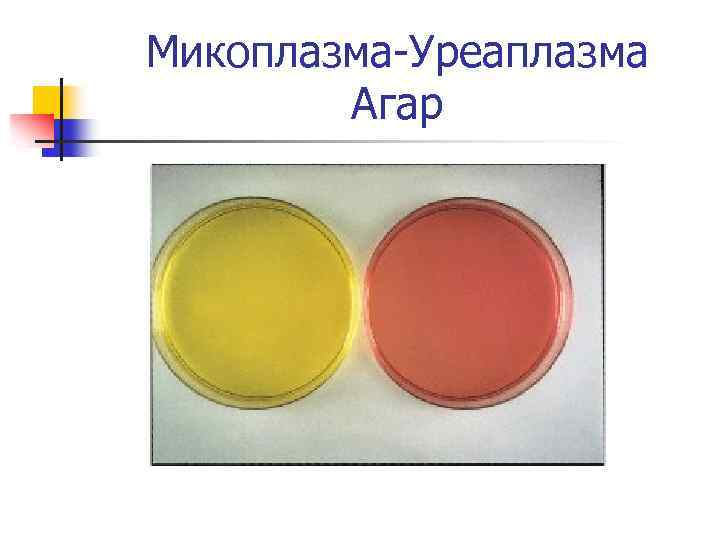Микоплазма-Уреаплазма Агар 