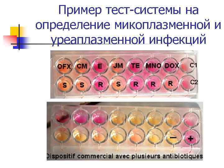 Пример тест-системы на определение микоплазменной и уреаплазменной инфекций 