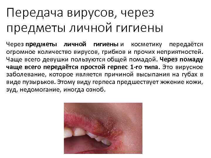 Передача вирусов, через предметы личной гигиены Через предметы личной гигиены и косметику передаётся огромное