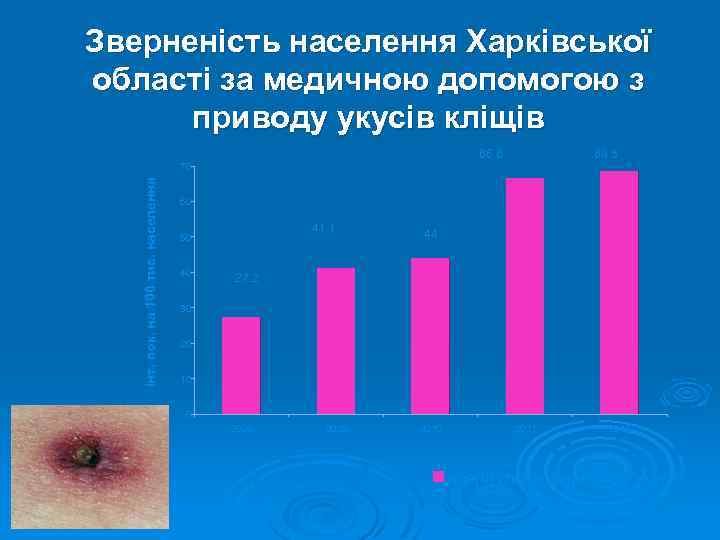 Зверненість населення Харківської області за медичною допомогою з приводу укусів кліщів 66. 6 68.