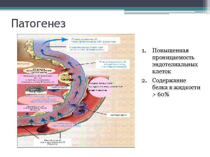 Патогенез 1. Повышенная проницаемость эндотелиальных клеток 2. Содержание белка в жидкости > 60% 