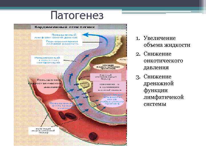 Патогенез 1. Увеличение объема жидкости 2. Снижение онкотического давления 3. Снижение дренажной функции лимфатичекой