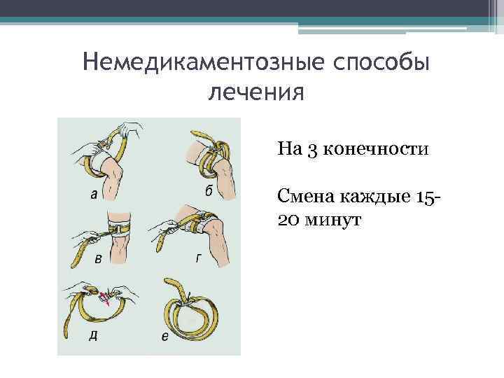 Немедикаментозные способы лечения На 3 конечности Смена каждые 1520 минут 