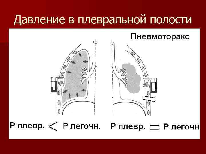 Давление в плевральной полости 