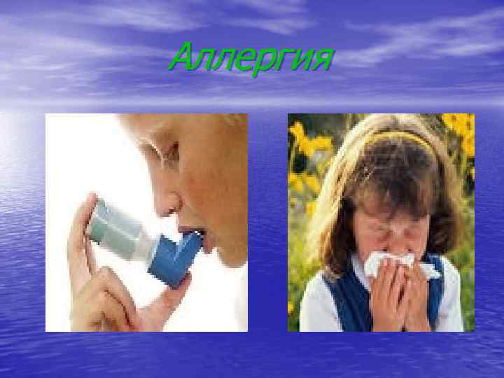 Аллергия 