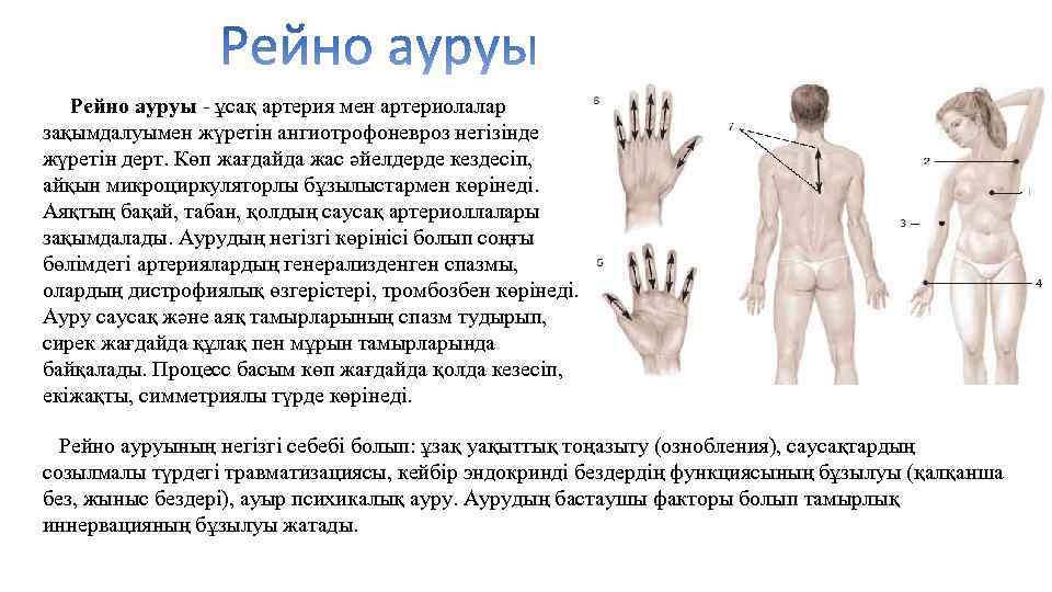 Рейно ауруы - ұсақ артерия мен артериолалар зақымдалуымен жүретін ангиотрофоневроз негізінде жүретін дерт. Көп