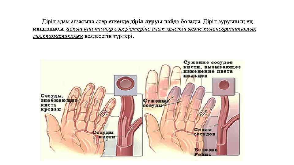 Өндірістік шу мен діріл презентация