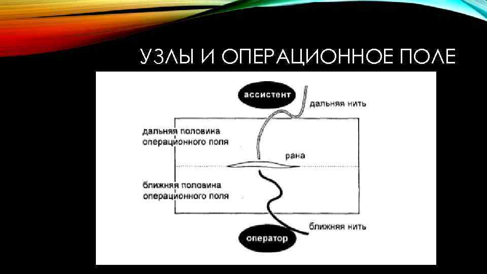 УЗЛЫ И ОПЕРАЦИОННОЕ ПОЛЕ 